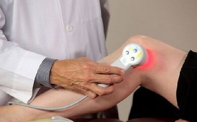 Les méthodes de traitement de l'arthrose de l'articulation du genou